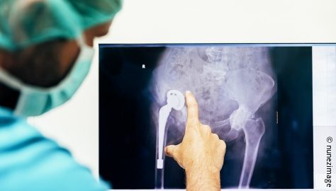 Drohende Engpässe bei orthopädischen und unfallchirurgischen Implantaten